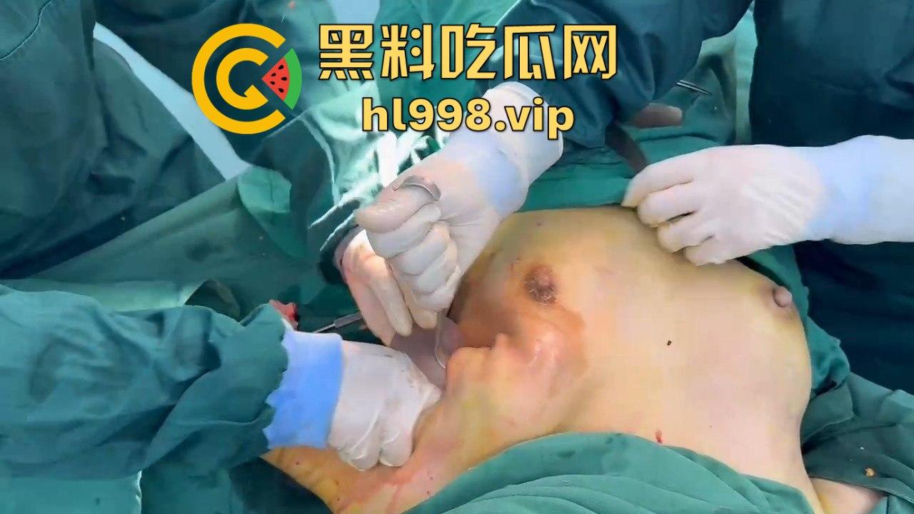 揭秘黄晓明女友『叶柯』同款隆胸术手术过程,看的让人心惊!胸被医生猛戳猛捣,视觉冲击强到不敢看!-8