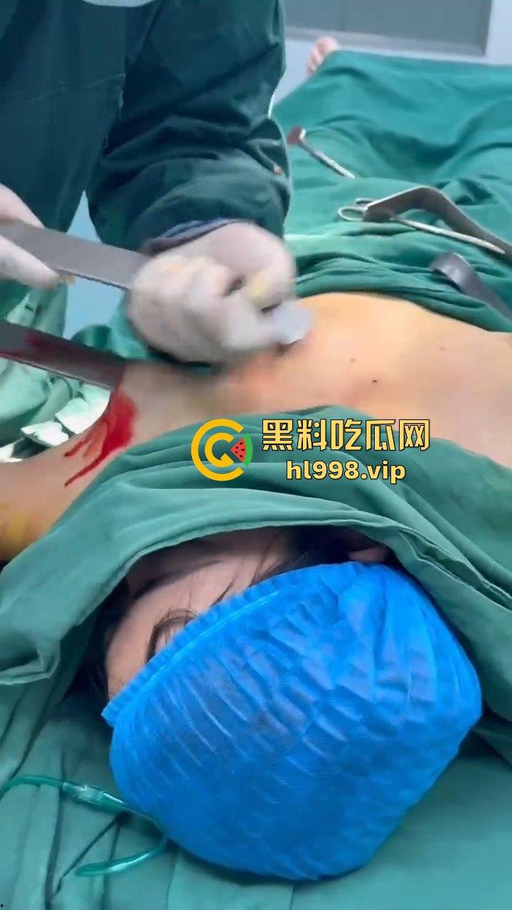 揭秘黄晓明女友『叶柯』同款隆胸术手术过程,看的让人心惊!胸被医生猛戳猛捣,视觉冲击强到不敢看!-10