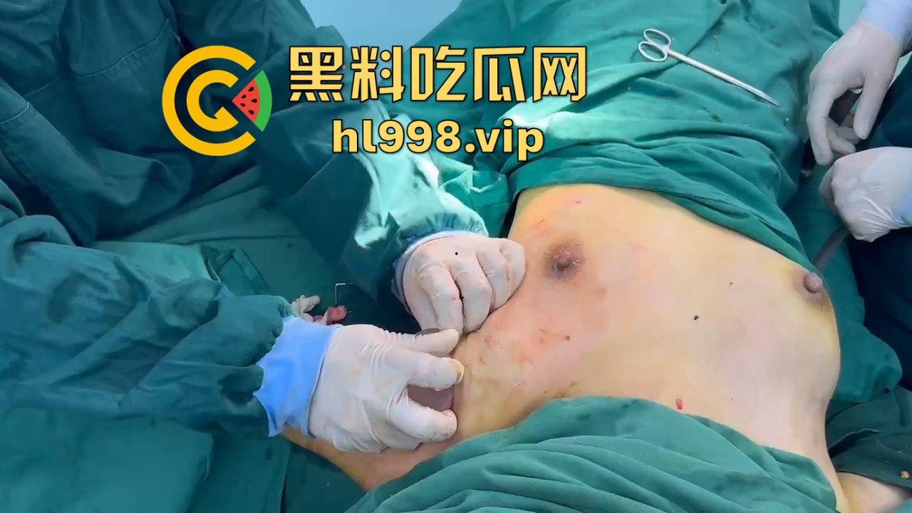 揭秘黄晓明女友『叶柯』同款隆胸术手术过程,看的让人心惊!胸被医生猛戳猛捣,视觉冲击强到不敢看!-11