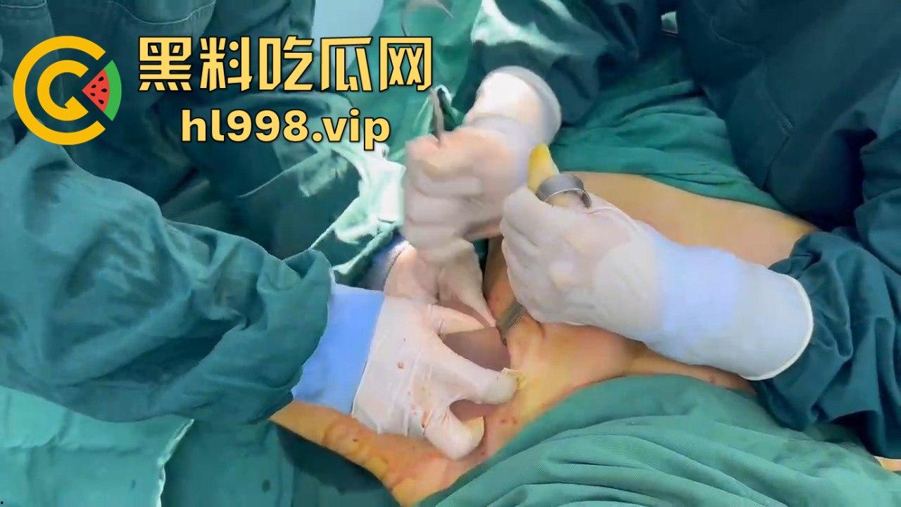 揭秘黄晓明女友『叶柯』同款隆胸术手术过程,看的让人心惊!胸被医生猛戳猛捣,视觉冲击强到不敢看!-15