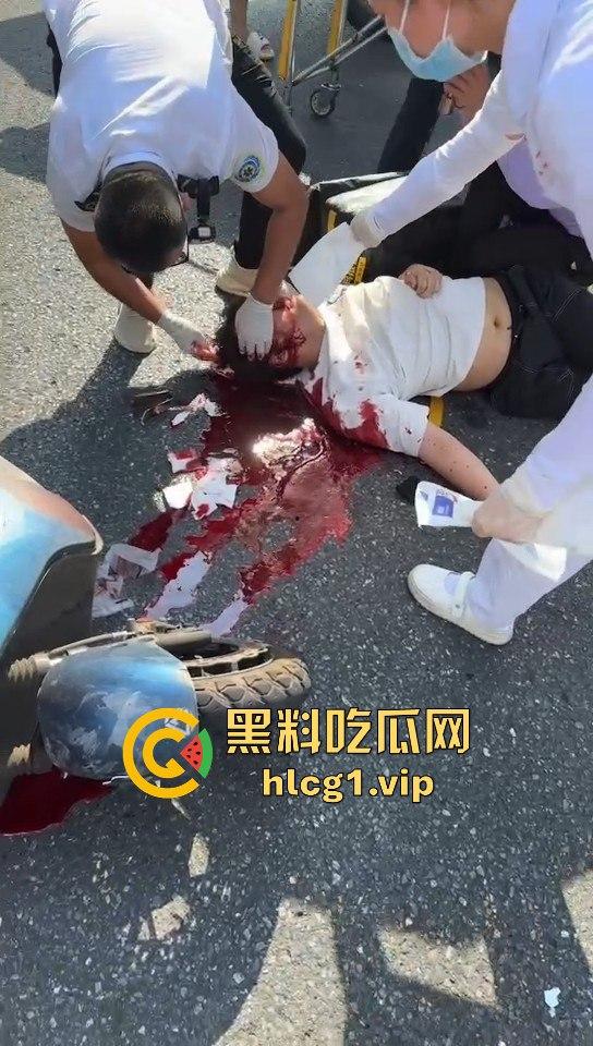 外卖小哥摩托车撞倒女子，女子头破血流浑身抽搐！
