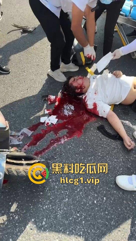 外卖小哥摩托车撞倒女子,女子头破血流浑身抽搐!-2