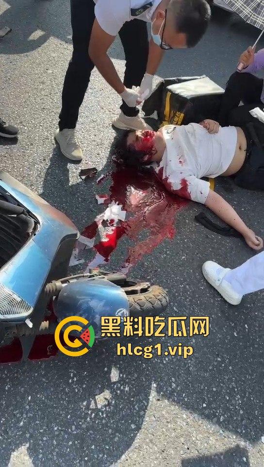 外卖小哥摩托车撞倒女子,女子头破血流浑身抽搐!-8