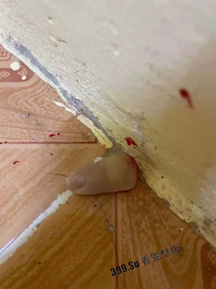 中国女孩王某被人诱骗到柬埔寨 后遭越南人绑架 被切掉一根 手指,并拍摄下视频威胁其国内家人勒索500万-5