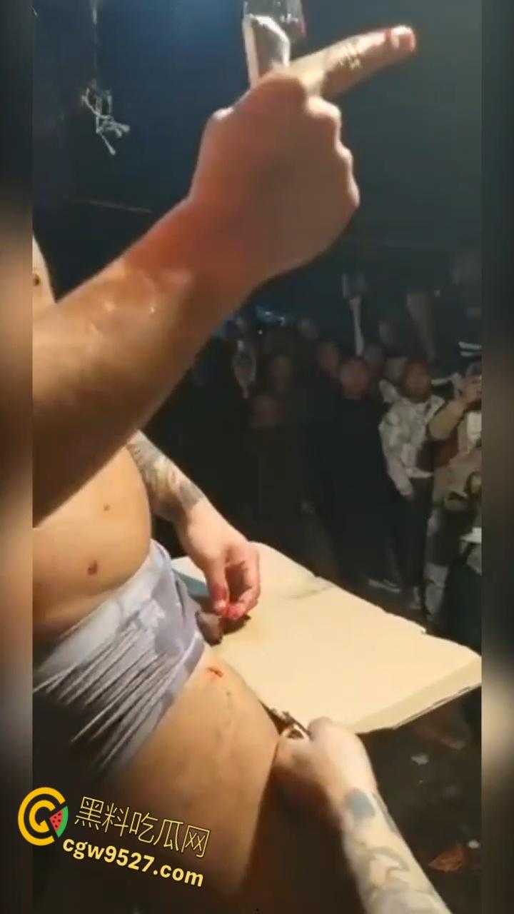 猎奇的重口慎入!男子当街表演,男子拿着砍刀割包皮,满桌子都是血,是因为不想让医院挣那么多钱吗 ?-2