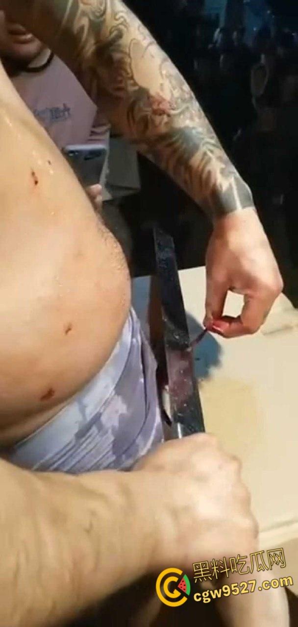 猎奇的重口慎入!男子当街表演,男子拿着砍刀割包皮,满桌子都是血,是因为不想让医院挣那么多钱吗 ?-5