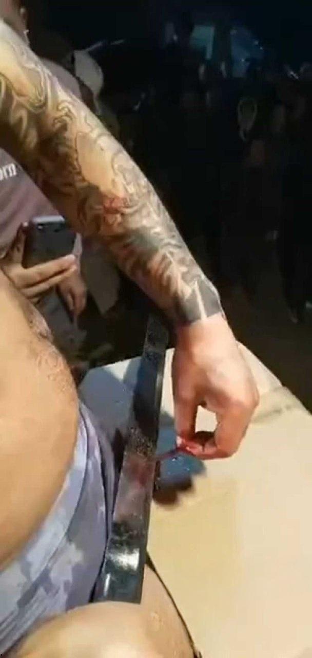 猎奇的重口慎入!男子当街表演,男子拿着砍刀割包皮,满桌子都是血,是因为不想让医院挣那么多钱吗 ?-7