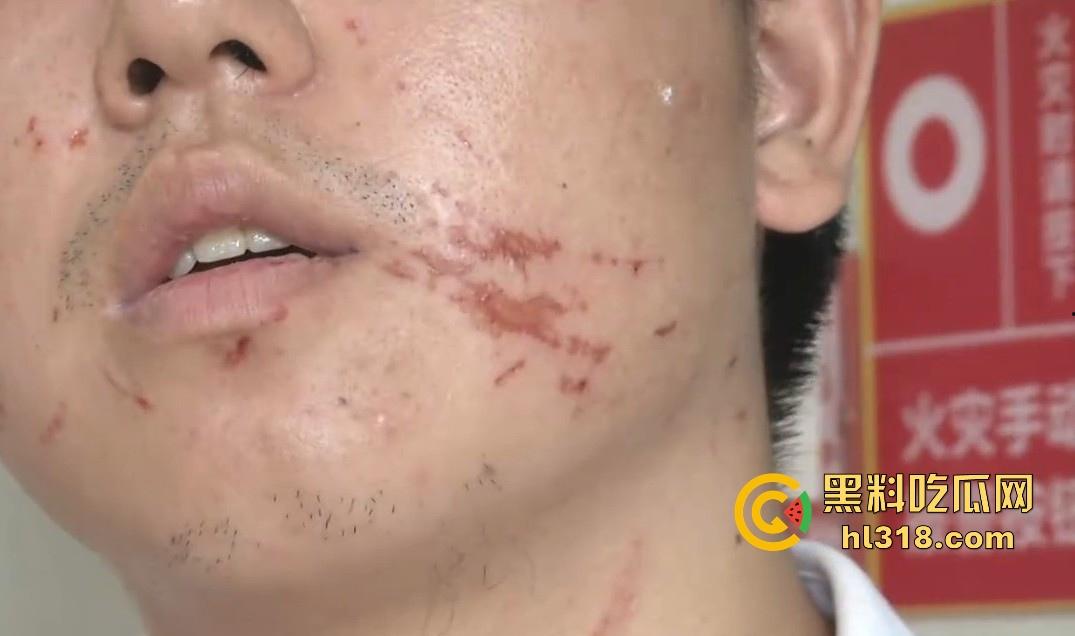 小哥网上想约炮台球助教，想摸人家的丝袜美腿，不料线下被坑5000多，还给打了一顿，真是陪了夫人又折兵！-9