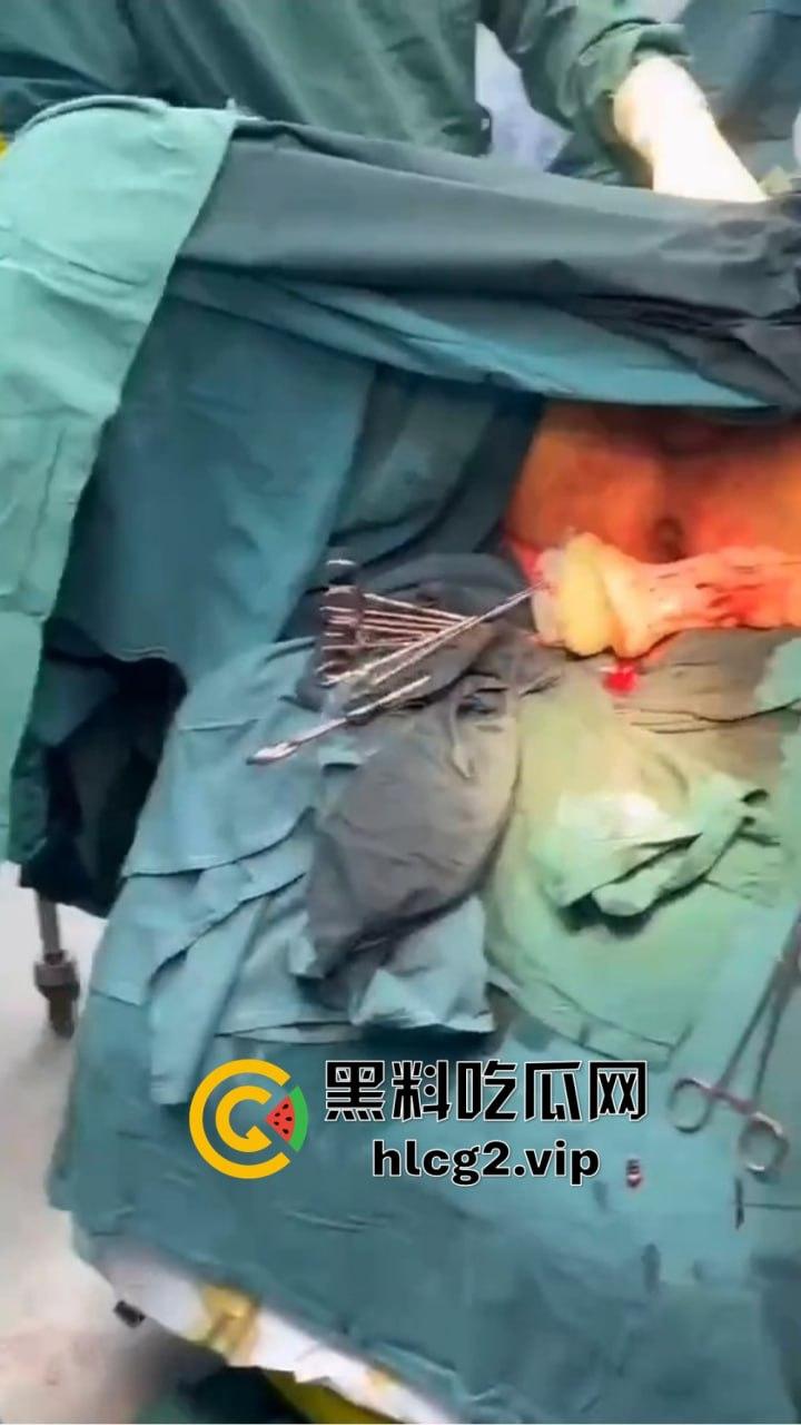 重口慎点!男子硬塞20厘米假体进体内,女子螃蟹夹逼狠整,为了流量太拼了!-7