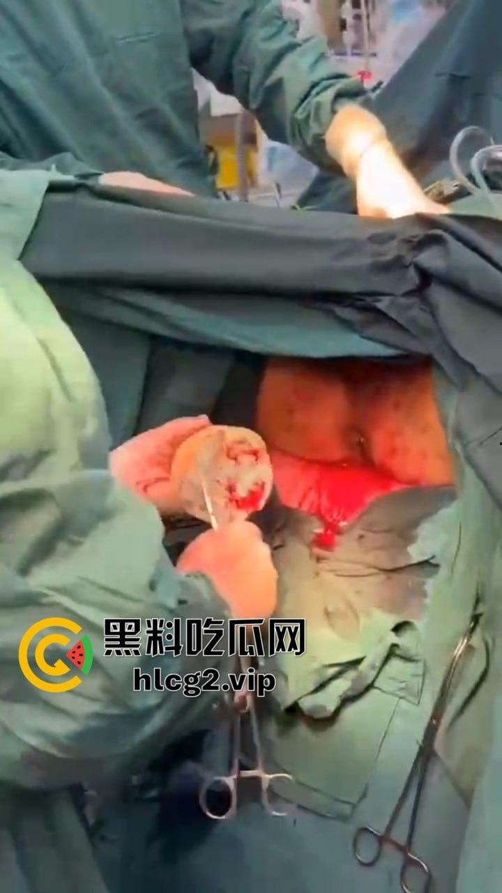 重口慎点!男子硬塞20厘米假体进体内,女子螃蟹夹逼狠整,为了流量太拼了!-8