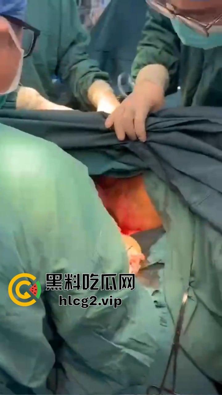 重口慎点!男子硬塞20厘米假体进体内,女子螃蟹夹逼狠整,为了流量太拼了!-9