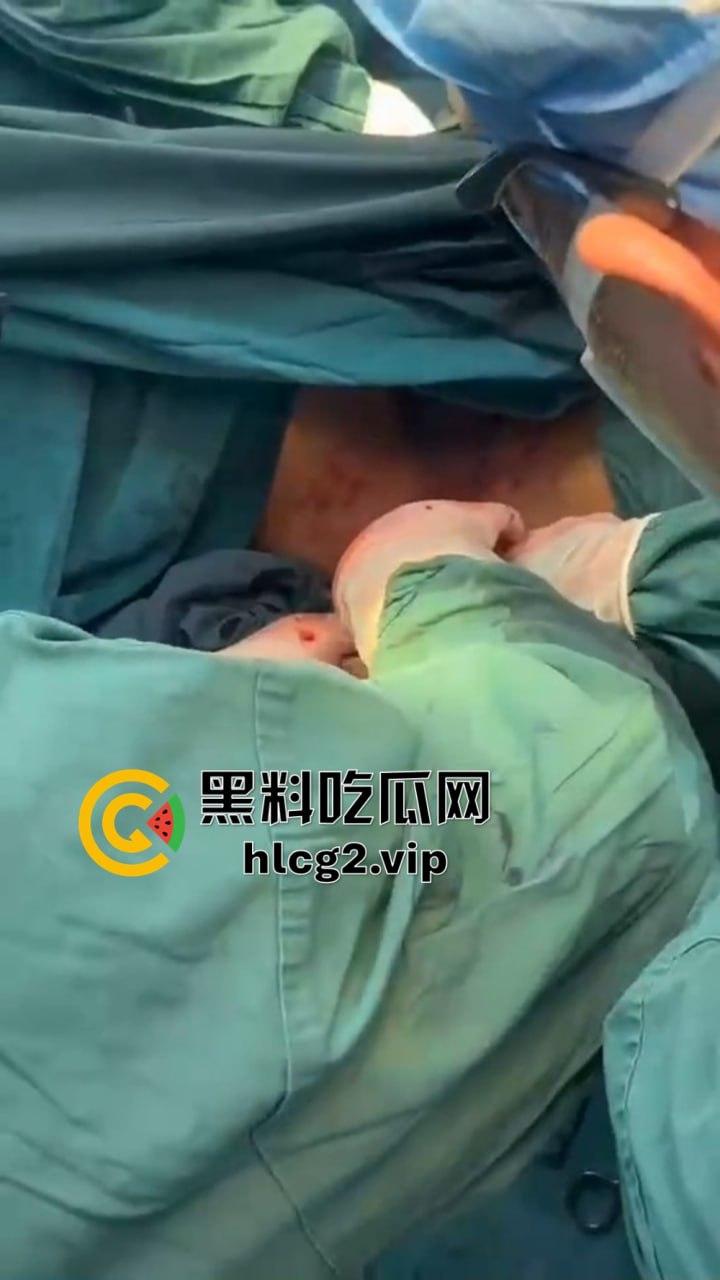 重口慎点!男子硬塞20厘米假体进体内,女子螃蟹夹逼狠整,为了流量太拼了!-10