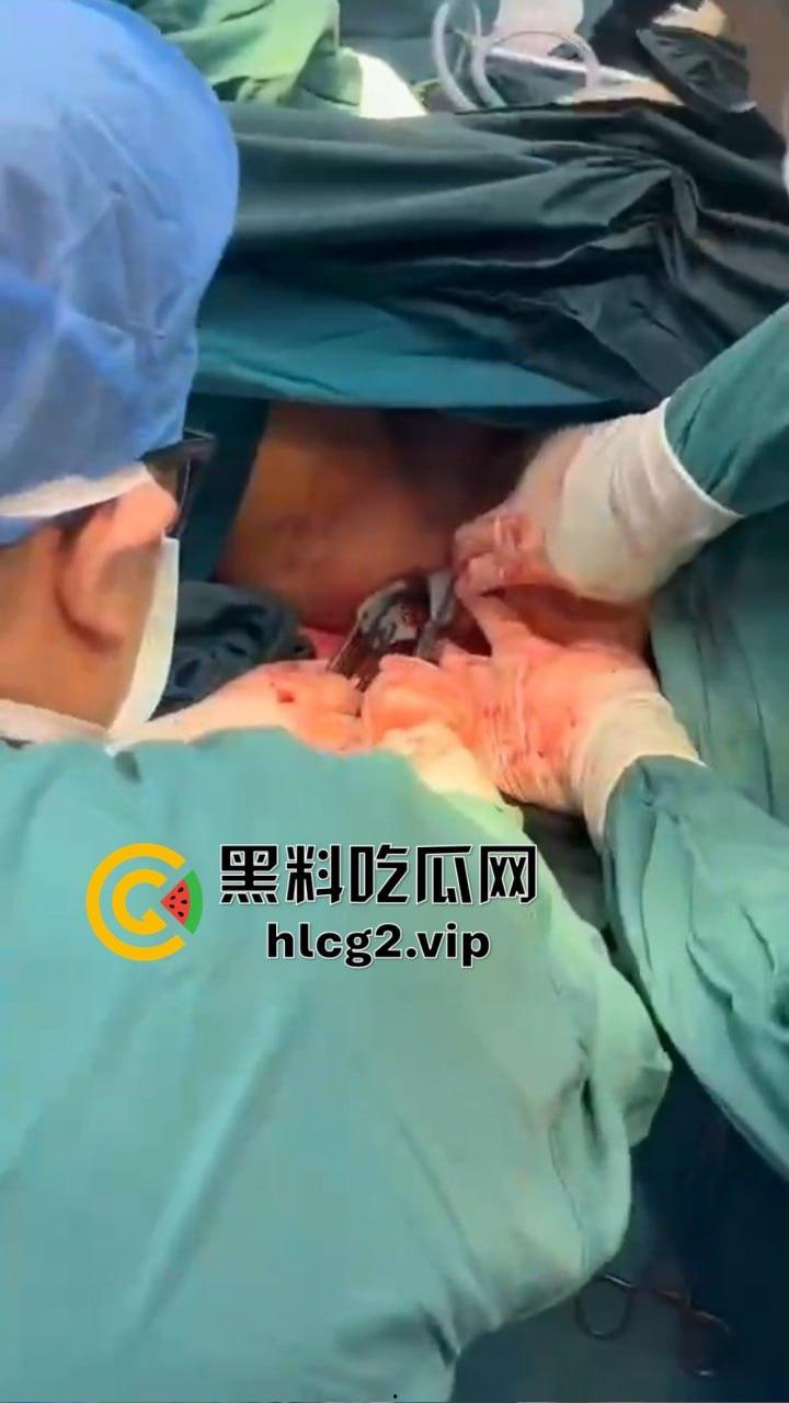 重口慎点!男子硬塞20厘米假体进体内,女子螃蟹夹逼狠整,为了流量太拼了!-11