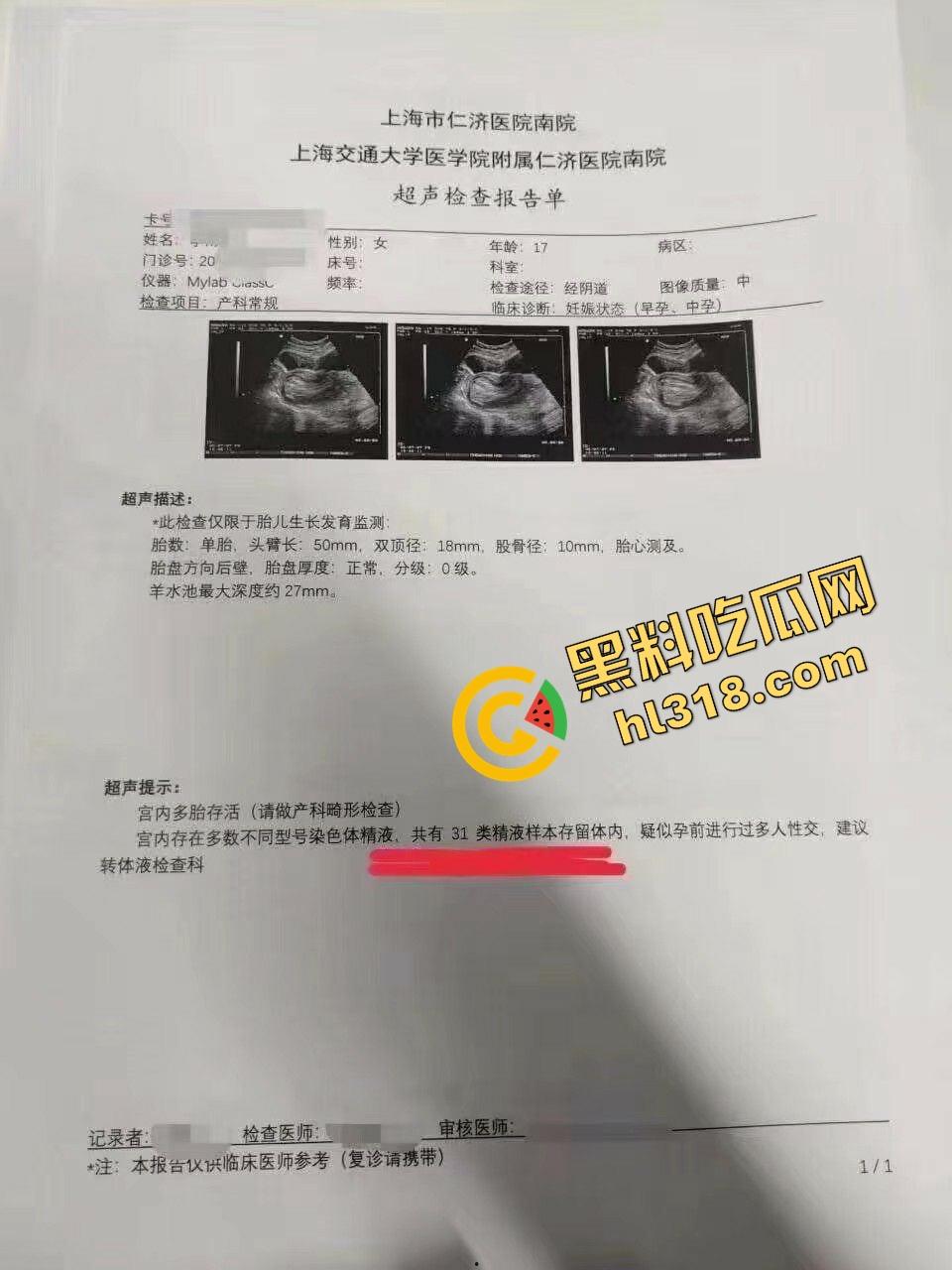 瓜友投稿女友身体不适去医院，体内查出31种精液化身精液小型联合国，当场自闭分手曝光手机视频！