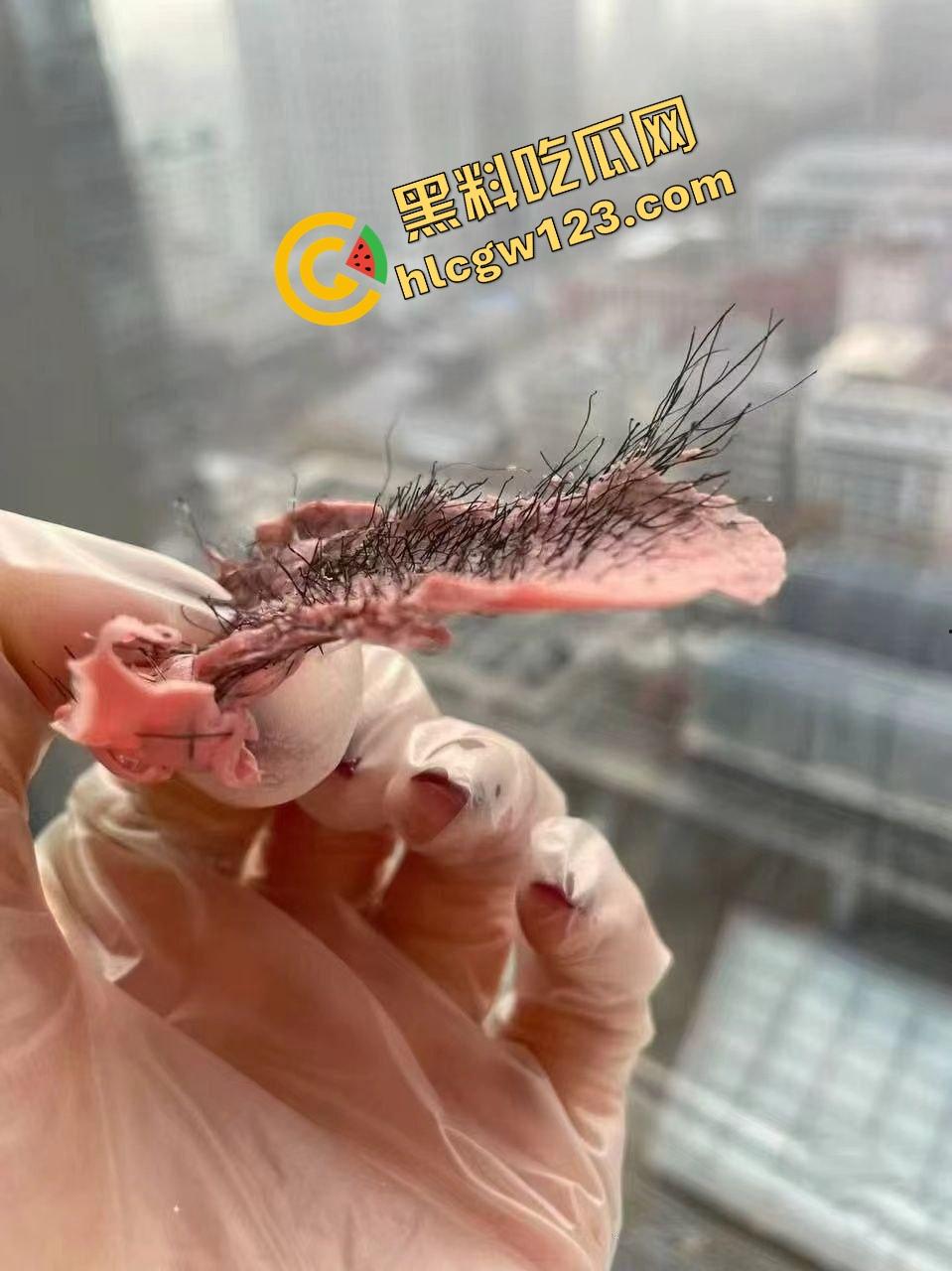 白虎不是天生的,是拔出来的,人工白虎养骗局曝光逼毛一根根扯,看得人蛋蛋一紧!-12