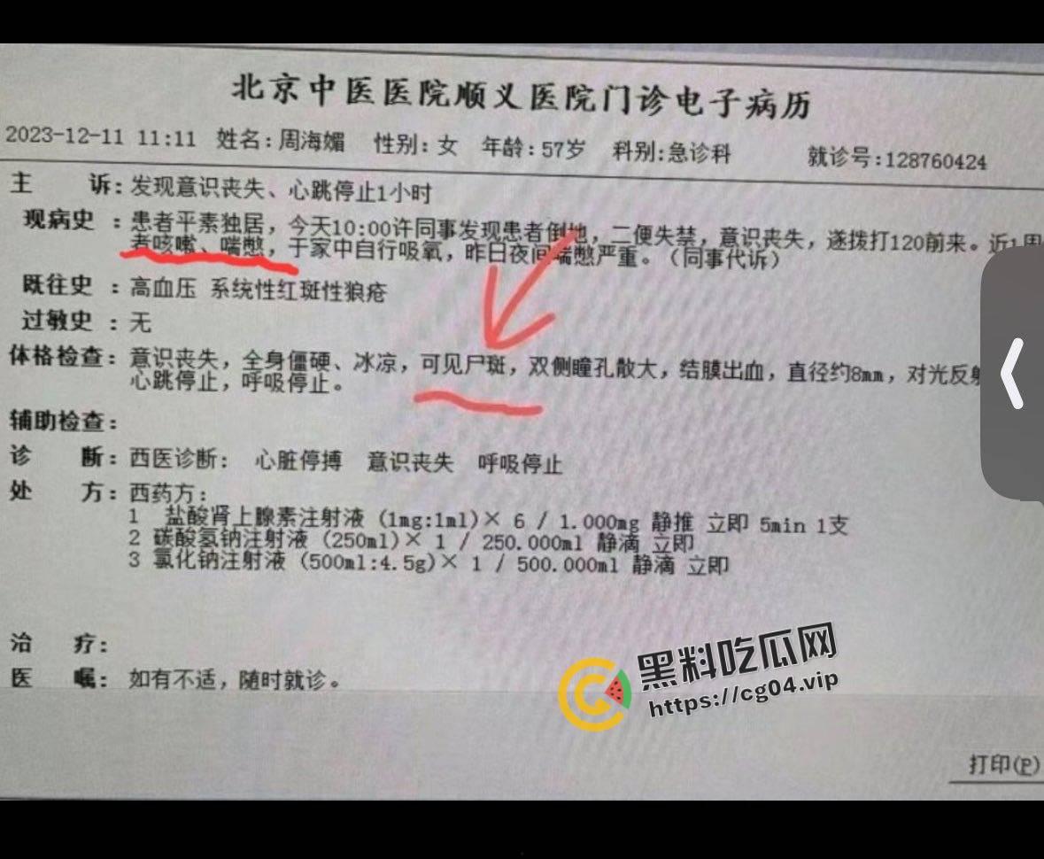 最新!周海媚死亡病例流出 去世前身上已有尸斑 流出的医生将被严惩-1