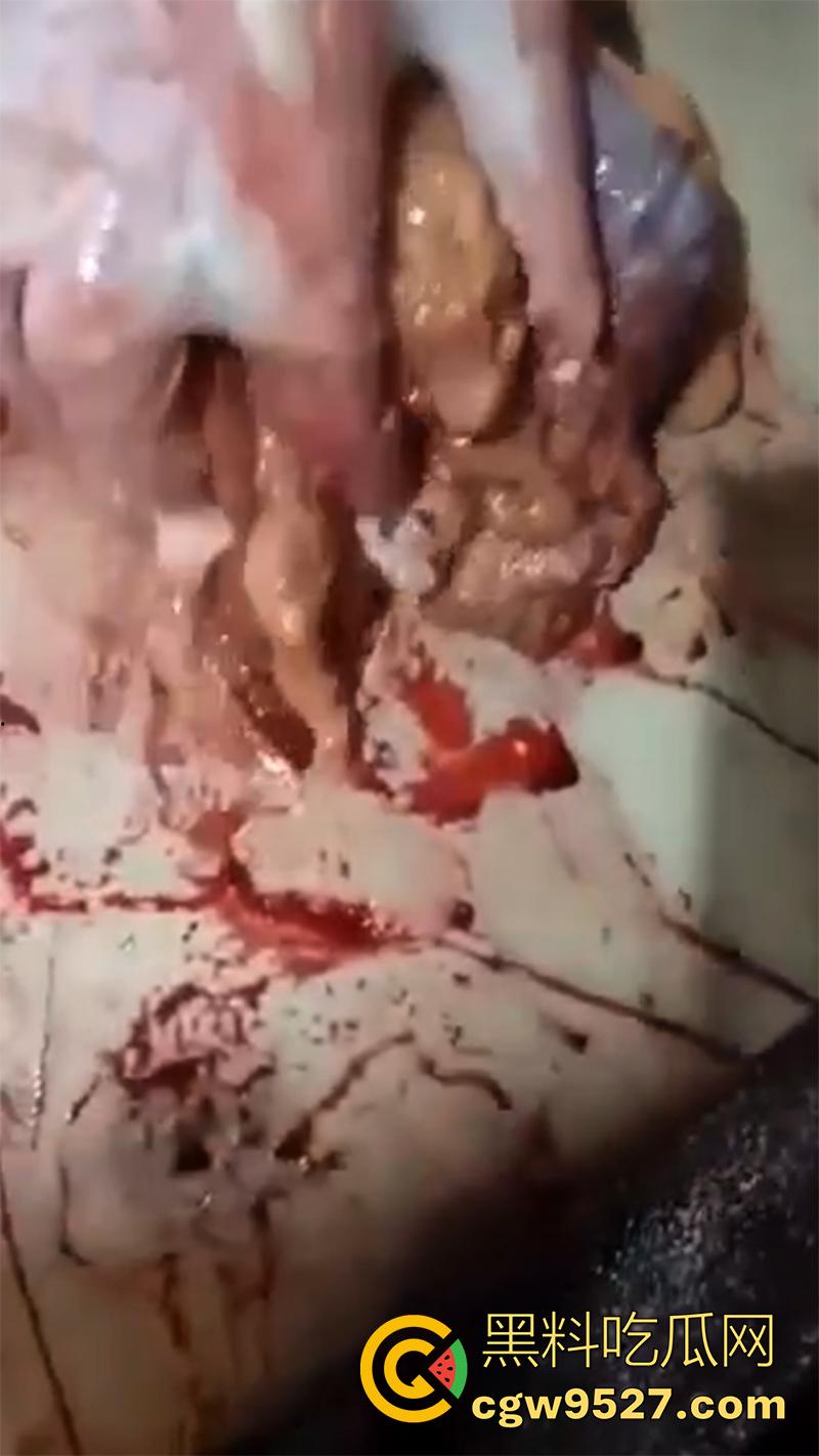 暗网流出血腥合集,吃人腿爆头剥皮车祸,想要的应有尽有,场面血腥过于重口,胆小者谨慎观看!-3