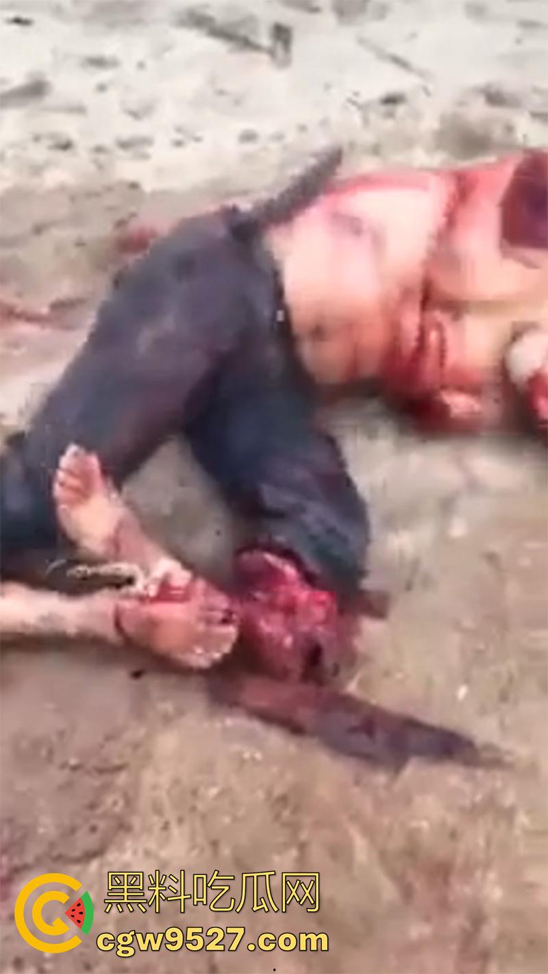暗网流出血腥合集,吃人腿爆头剥皮车祸,想要的应有尽有,场面血腥过于重口,胆小者谨慎观看!-5