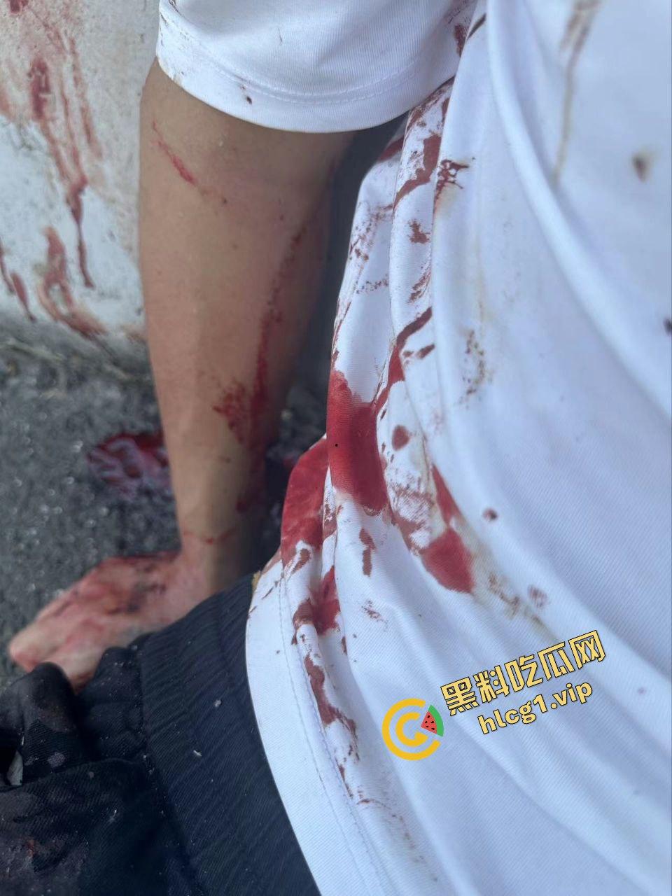 长安汽车高速车祸!严重车祸 血迹斑斑 然而气囊未弹 引人愤怒!-5