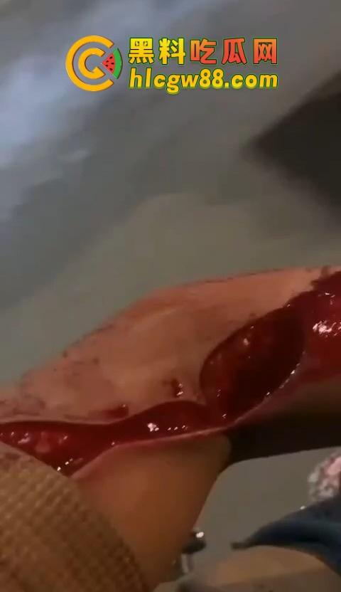 普宁盛产精神小伙,精神小伙又疯了?刀仔砍人血溅街头,这回不是社会摇,是进局子摇!-8