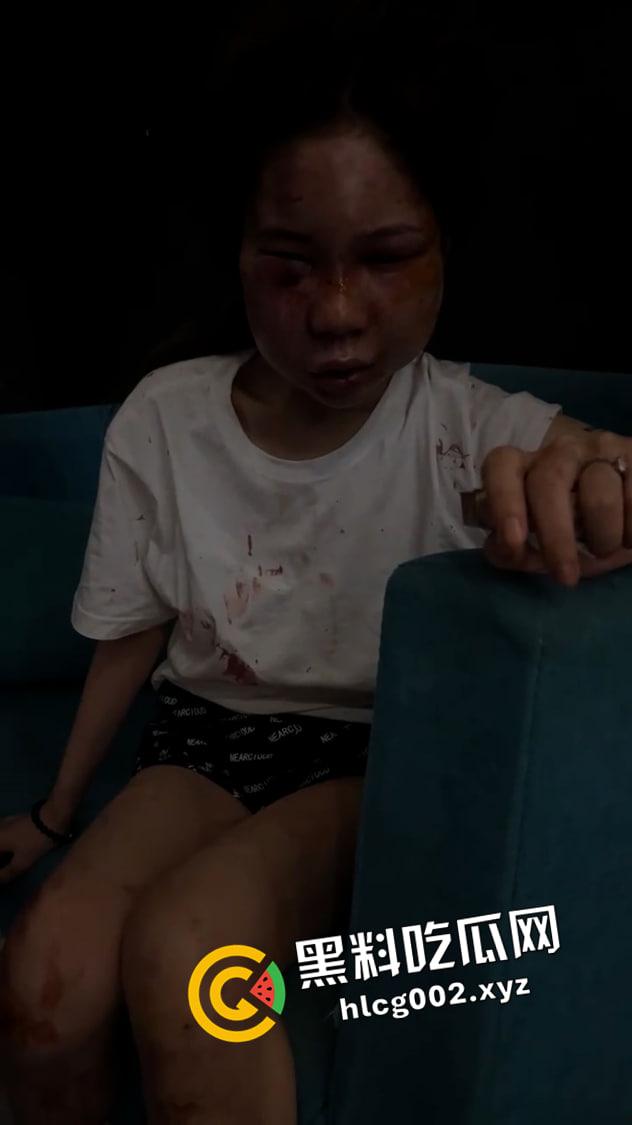 【谭竹】终被制裁打成猪头!外网悬赏金额已达六百万 现场视频流出-3