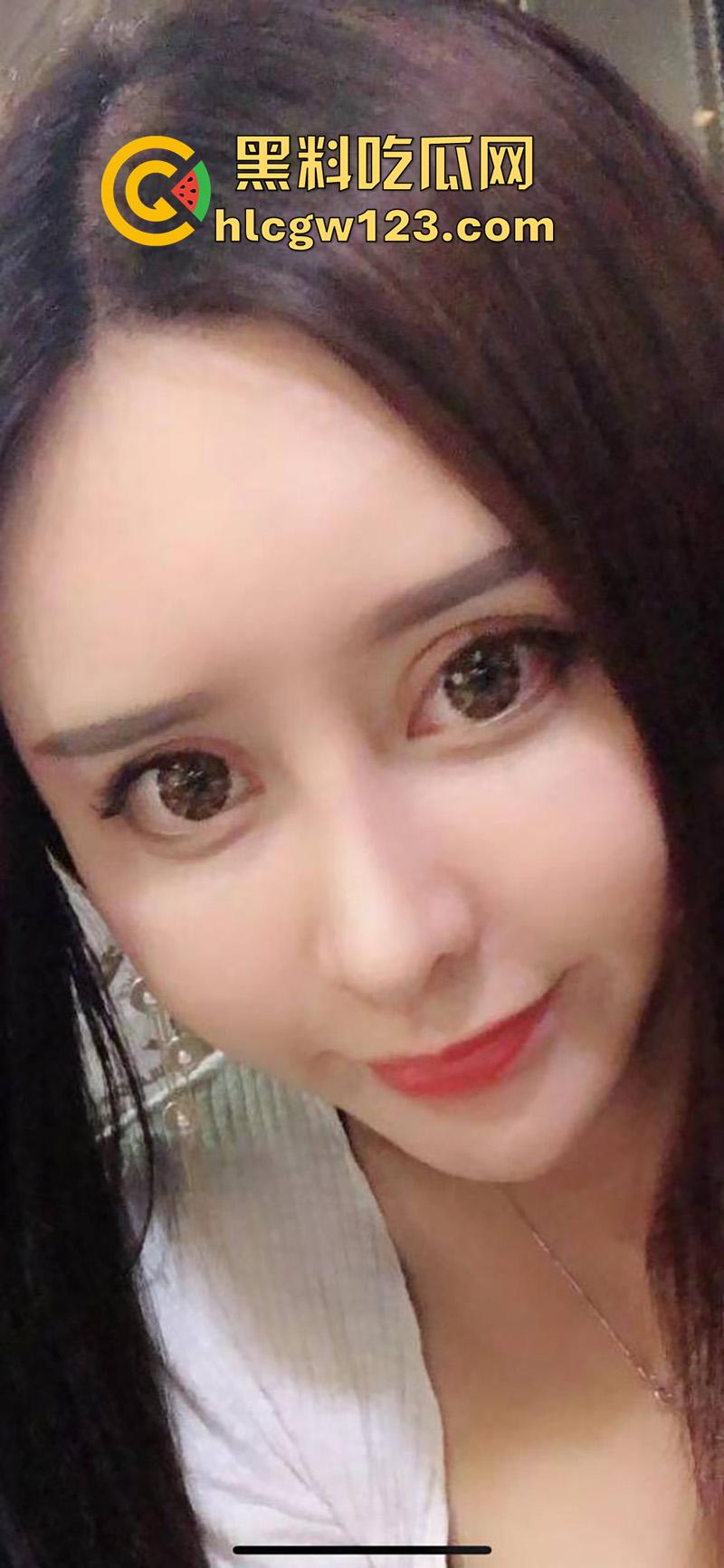 成都整容女生化母体,颜值高身材高挑性感,经常卖逼约炮染上梅毒,到处约炮感染年轻帅哥!-6