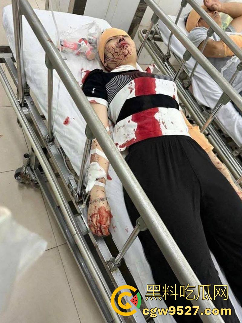 越南海防水果批发市场,发生重大砍人事件,男子手持菜刀疯狂劈砍,导致三人身受重伤,现场视频流出!-1