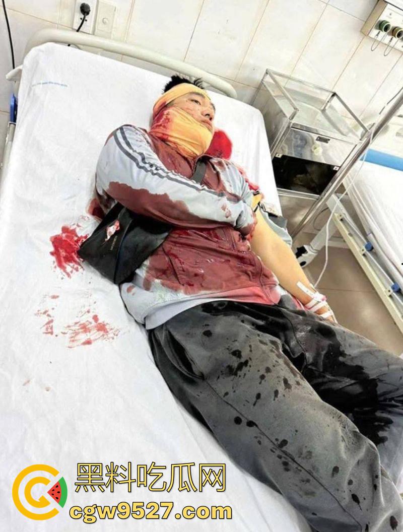 越南海防水果批发市场,发生重大砍人事件,男子手持菜刀疯狂劈砍,导致三人身受重伤,现场视频流出!-2