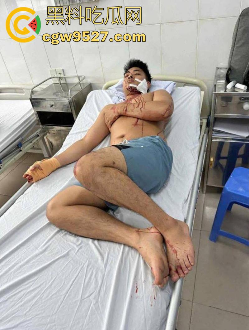 越南海防水果批发市场,发生重大砍人事件,男子手持菜刀疯狂劈砍,导致三人身受重伤,现场视频流出!-4