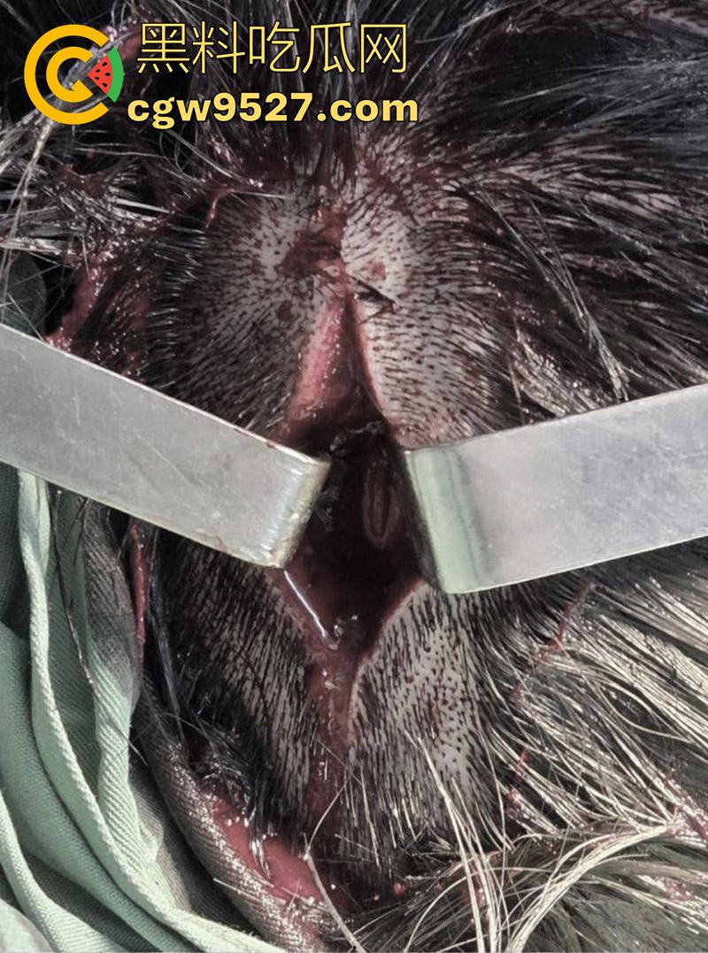 越南海防水果批发市场,发生重大砍人事件,男子手持菜刀疯狂劈砍,导致三人身受重伤,现场视频流出!-5