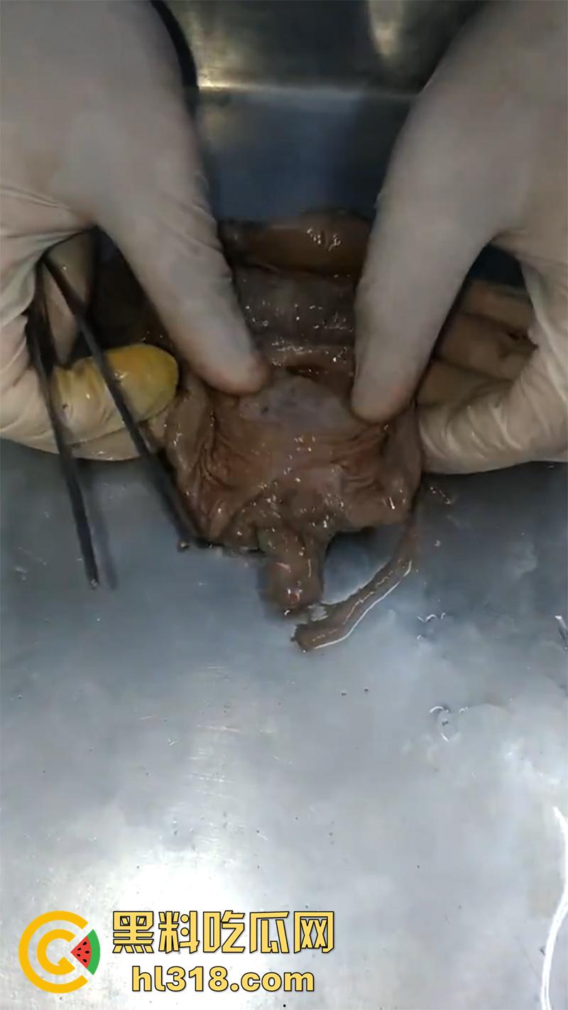 真实西藏密宗法器“肉莲花”,少女被108罗汉轮奸后,五毒侵蚀九蒸九炼,活体切割才可肉莲大成!-3