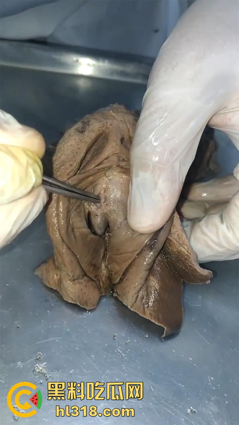 真实西藏密宗法器“肉莲花”,少女被108罗汉轮奸后,五毒侵蚀九蒸九炼,活体切割才可肉莲大成!-4