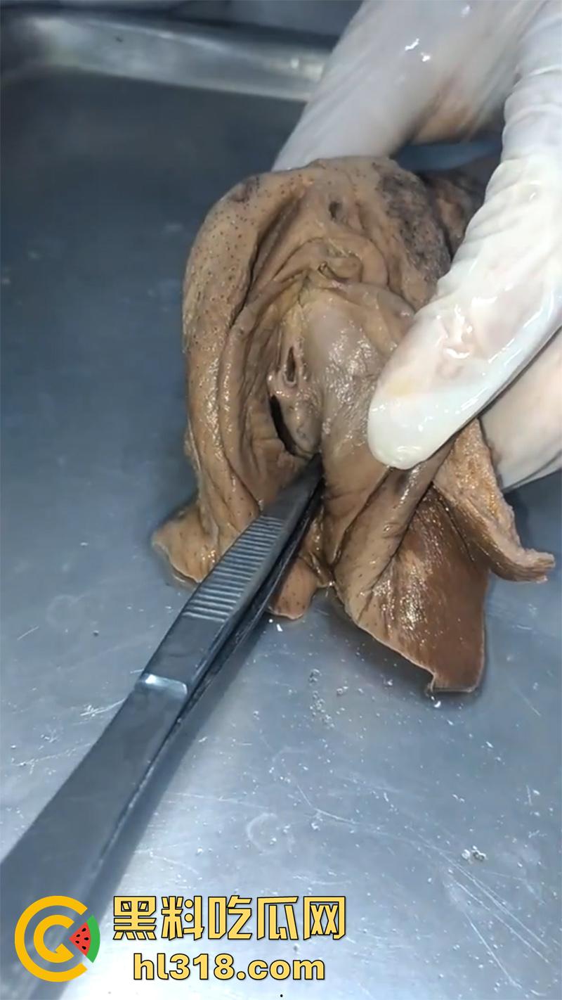 真实西藏密宗法器“肉莲花”,少女被108罗汉轮奸后,五毒侵蚀九蒸九炼,活体切割才可肉莲大成!-5