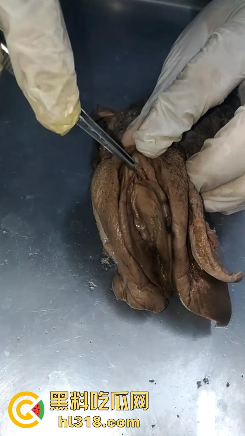 真实西藏密宗法器“肉莲花”,少女被108罗汉轮奸后,五毒侵蚀九蒸九炼,活体切割才可肉莲大成!-6