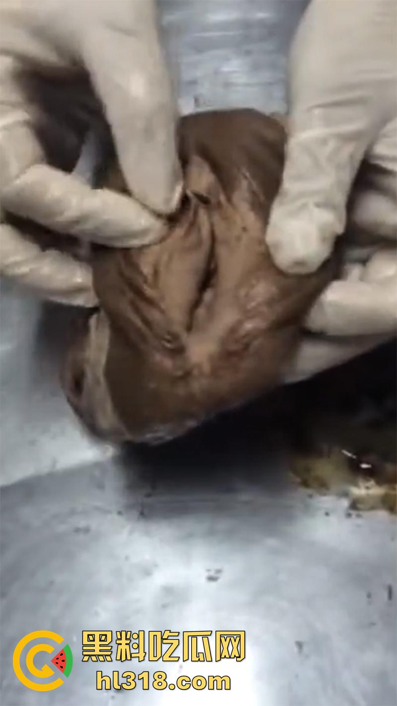 真实西藏密宗法器“肉莲花”,少女被108罗汉轮奸后,五毒侵蚀九蒸九炼,活体切割才可肉莲大成!-7