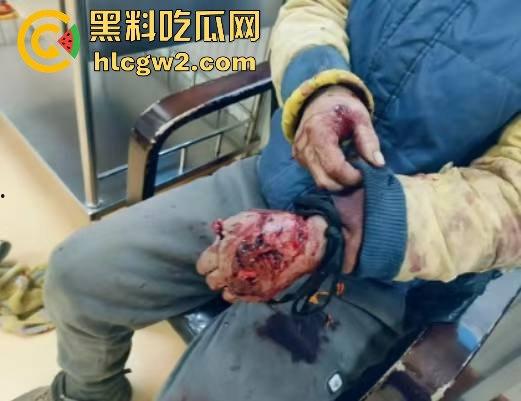 黑龙江勃利县长太村惊现野生东北虎入村 咬伤65岁大爷 大爷吃瓜看虎差点被虎吃 大爷还是大爷!-8