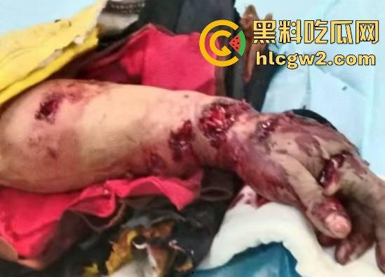 黑龙江勃利县长太村惊现野生东北虎入村 咬伤65岁大爷 大爷吃瓜看虎差点被虎吃 大爷还是大爷!-9