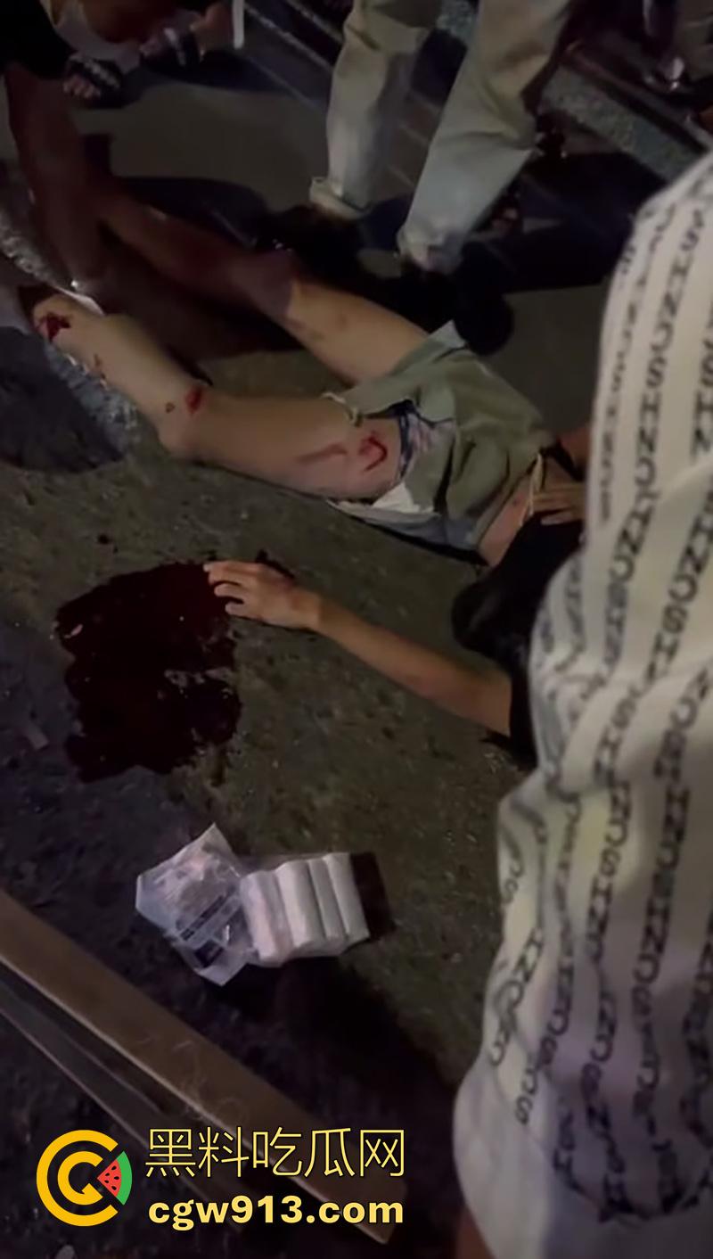 小伙骑摩托车夜晚狂飙，车辆失控撞上对面来车，女友当场飞出死亡，小伙自己全身骨折，看着都疼！-4